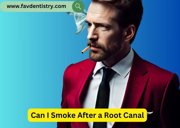 Can I Smoke After a Root Canal