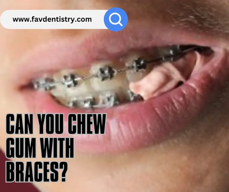 Can You Chew Gum With Braces?