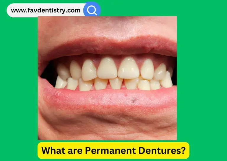 What are Permanent Dentures?