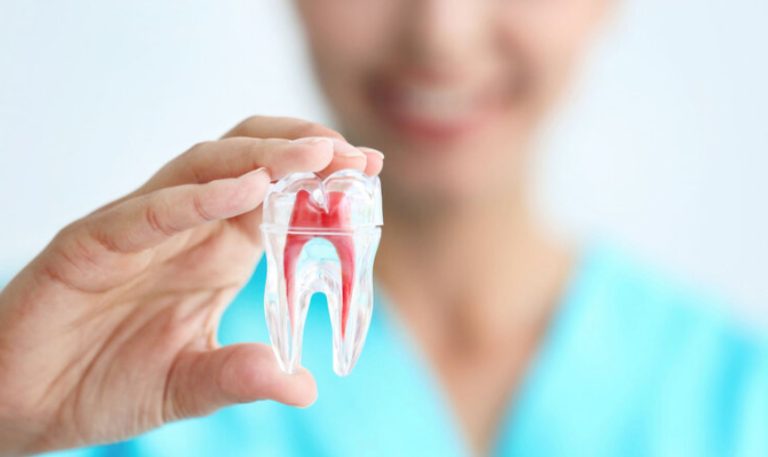 Can a Dds Masterfully Perform a Root Canal Procedure?