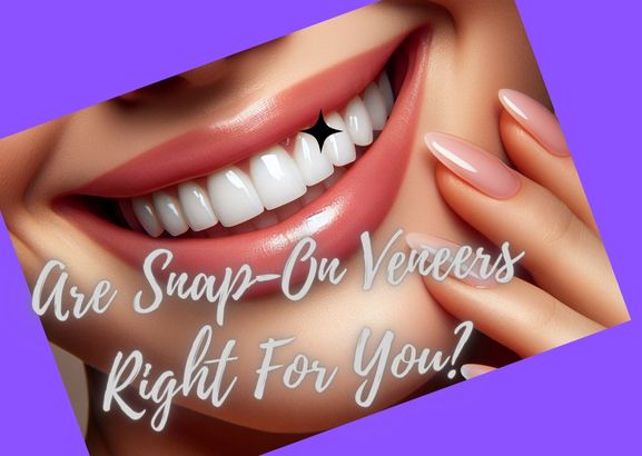 Are Snap-On Veneers Right For You?