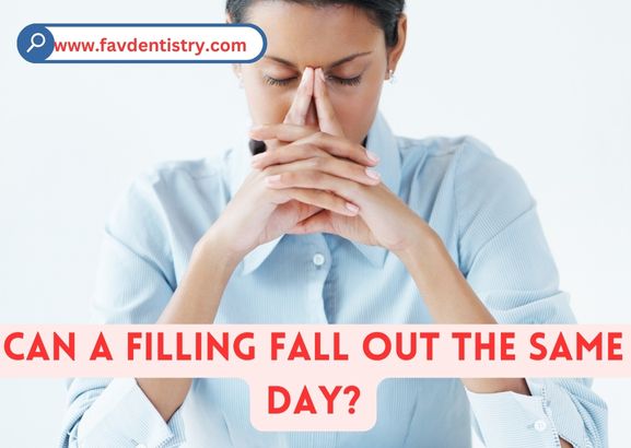 Can a Filling Fall Out the Same Day?: Beware of Potential Risks