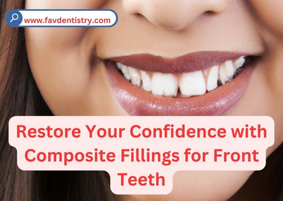Restore Your Confidence with Composite Fillings for Front Teeth