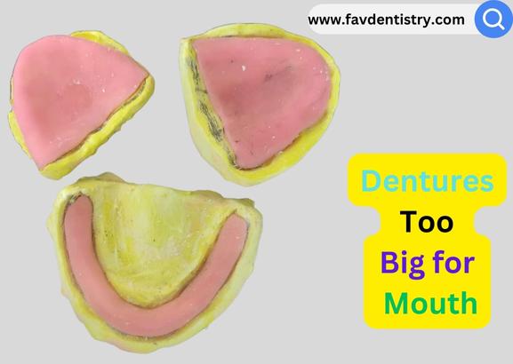 Dentures Too Big for Mouth : How to Solve the Issue Now