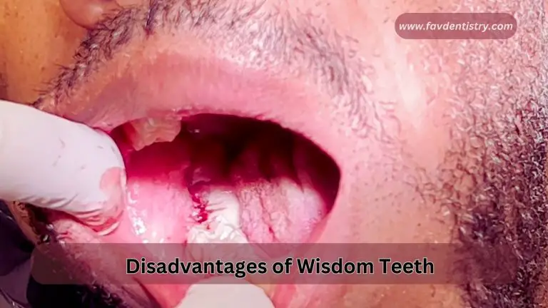 Disadvantages of Wisdom Teeth: Unraveling the Hidden Dangers
