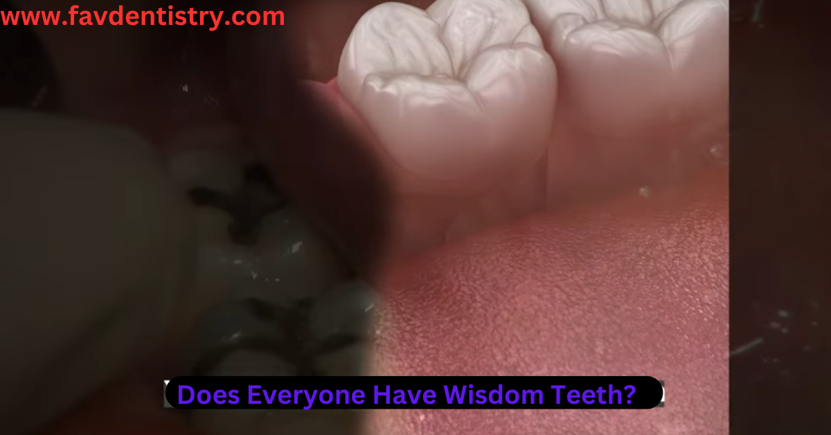 Does everyone have wisdom teeth favourite dentistry