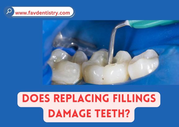 Does Replacing Fillings Damage Teeth? Learn the Truth Here