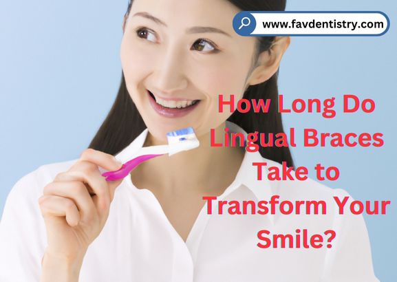 How Long Do Lingual Braces Take to Transform Your Smile?