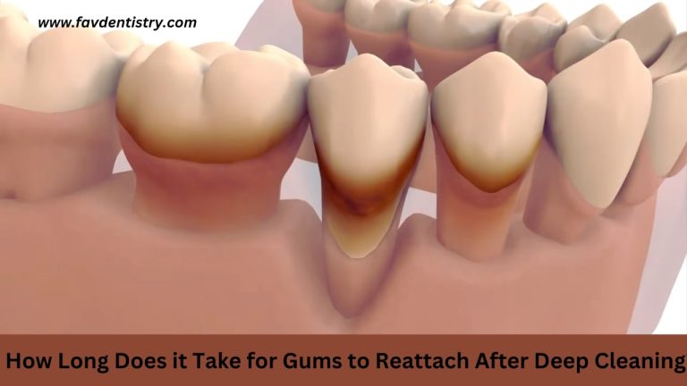 How Long Does it Take for Gums to Reattach After Deep Cleaning