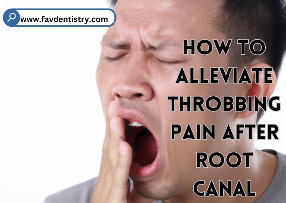How to Alleviate Throbbing Pain After Root Canal: Expert Relief Methods
