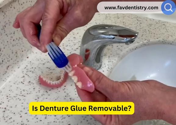 Is Denture Glue Removable?