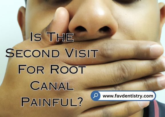Discover the Second Visit for Root Canal: A Pain-Free Experience
