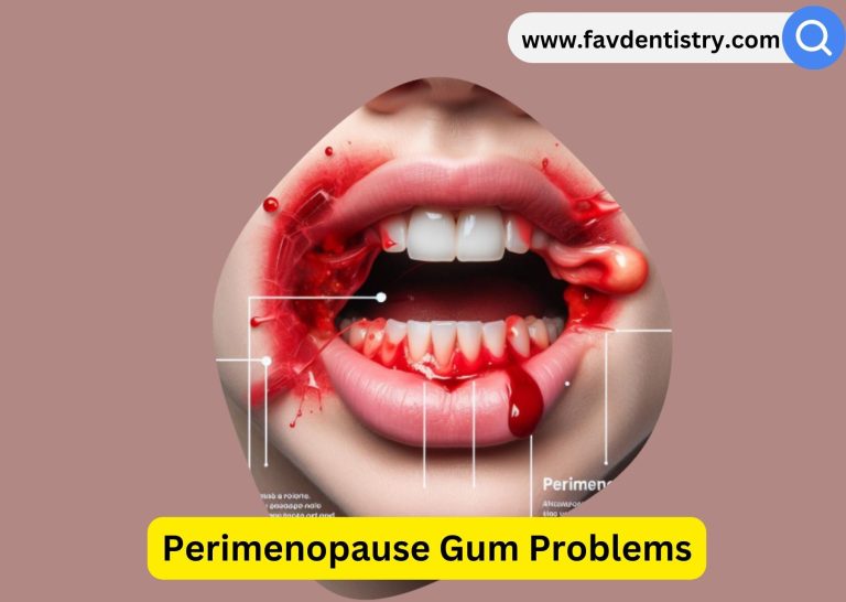 Perimenopause Gum Problems: How to Prevent and Soothe Oral Health Issues