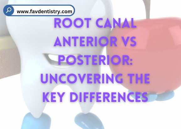 Root Canal Anterior Vs Posterior: Uncovering the Key Differences