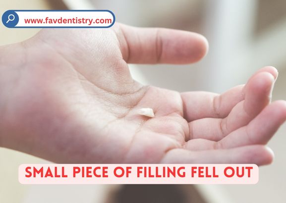 Small Piece of Filling Fell Out: Simple Fixes for Tooth Fillings