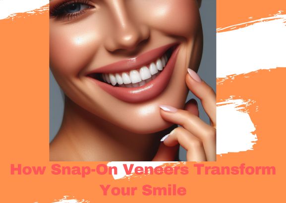 How Snap-On Veneers Transform Your Smile