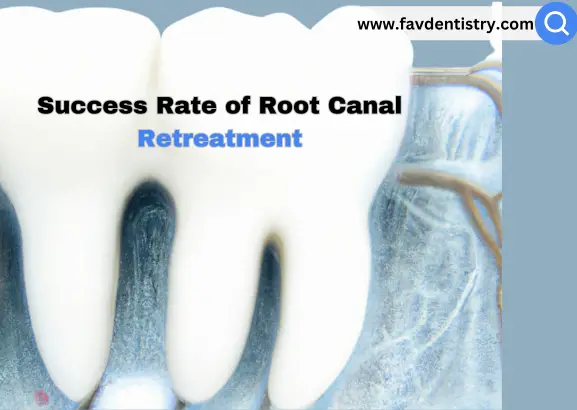 Success Rate of Root Canal Retreatment