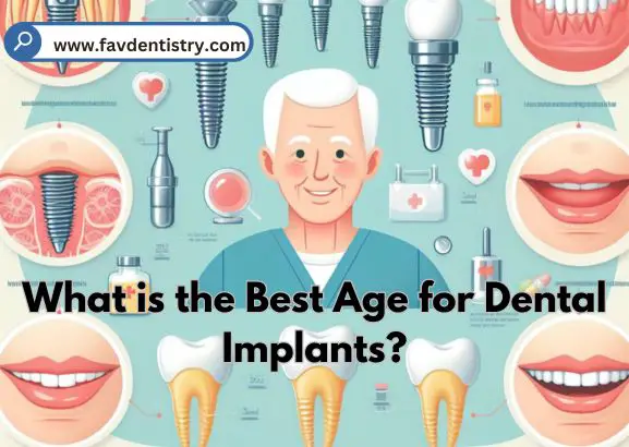 What is the Best Age for Dental Implants?