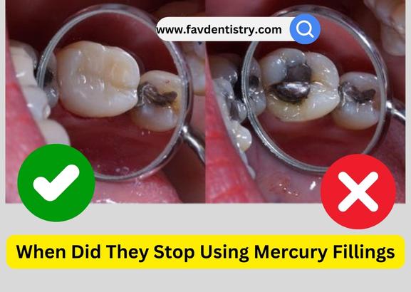 When Did They Stop Using Mercury Fillings