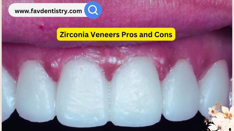 Zirconia Veneers Pros and Cons