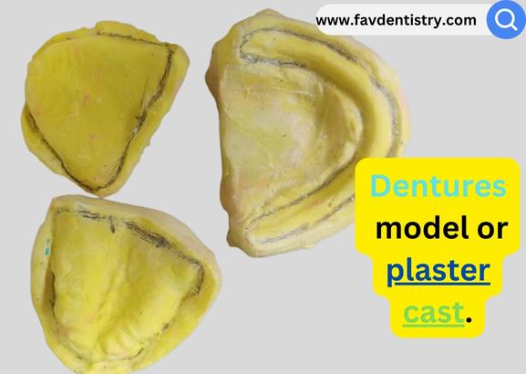 dentures model or plaster cast