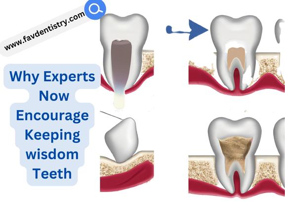 Why Experts Now Encourage Keeping wisdom Teeth