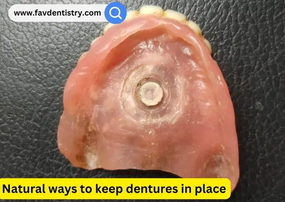 Natural ways to keep dentures in place
