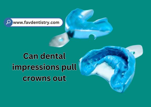 Can Dental Impressions Pull Crowns Out?