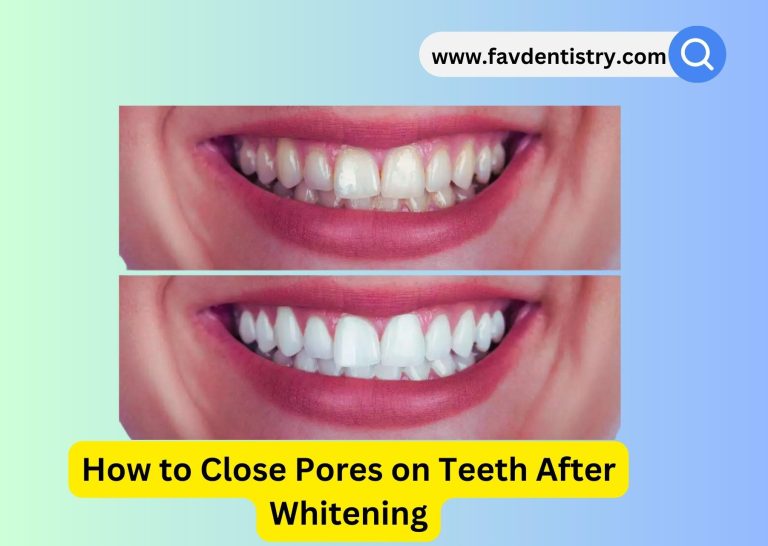 How to Close Pores on Teeth After Whitening