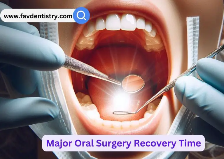 Major Oral Surgery Recovery Time  : Essential Tips for a Speedy Recovery