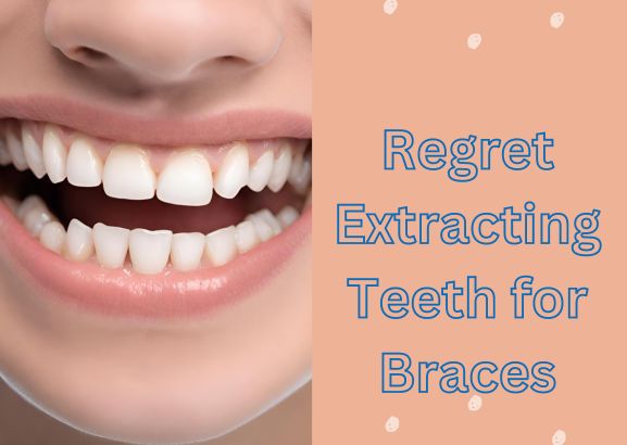 Regret Extracting Teeth for Braces