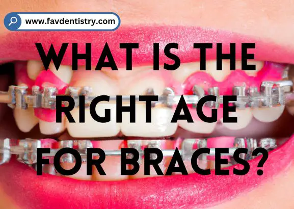 What is the right age for braces