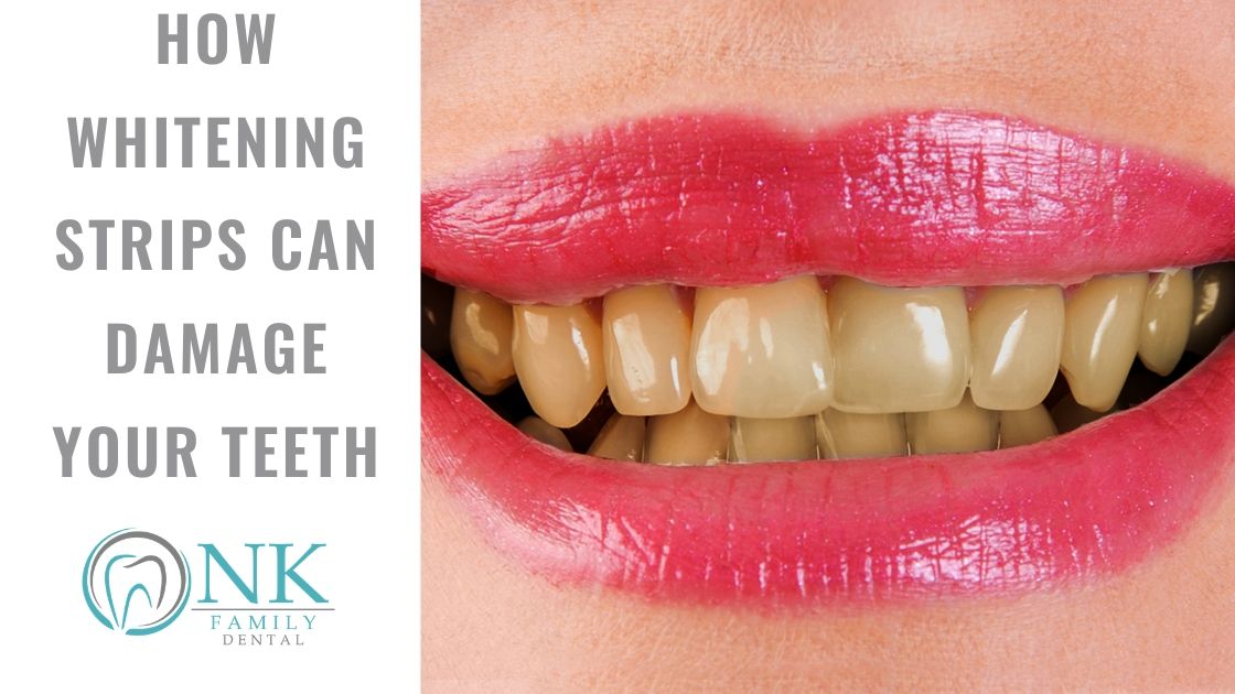 Are Crest White Strips Bad for Your Teeth