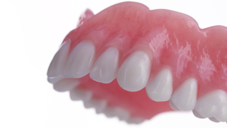 Comfilyte Dentures Cost: Affordable Options for Comfortable Smiles