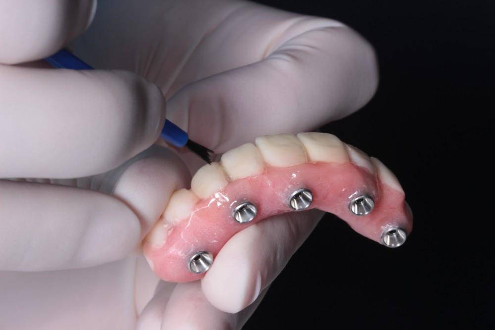 Front Teeth Partial Dentures Changed My Life