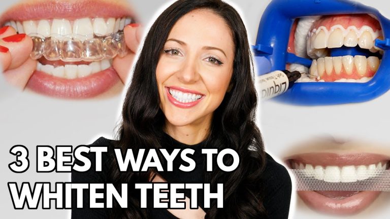 How to Whiten Your Teeth at Home