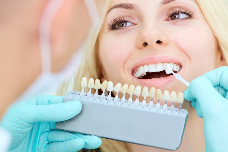 Types of Teeth Whitening at Dentist