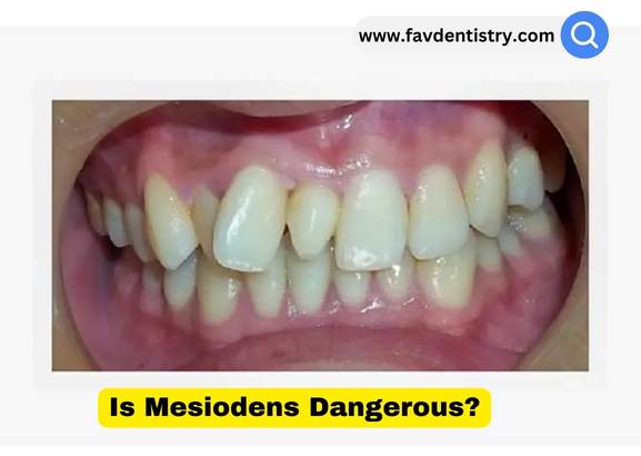 Is Mesiodens Dangerous?
