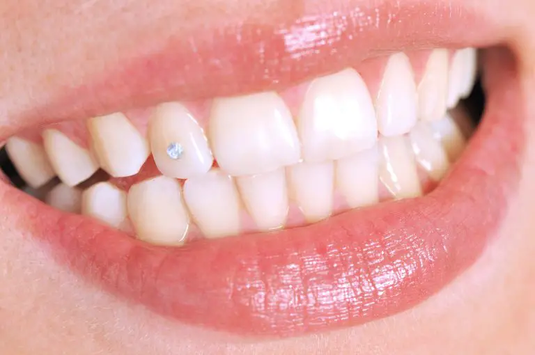 Tooth Gems: Sparkle Your Smile with Trendy Bling!