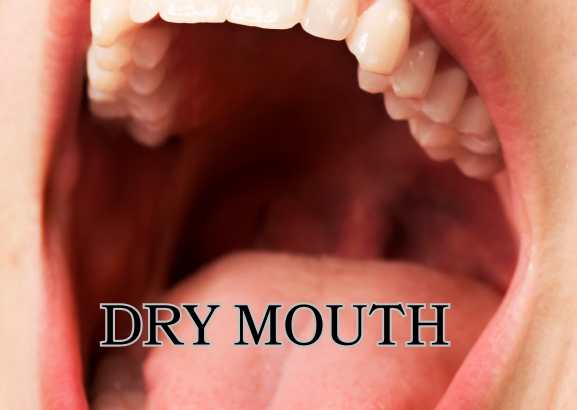 DRY MOUTH
