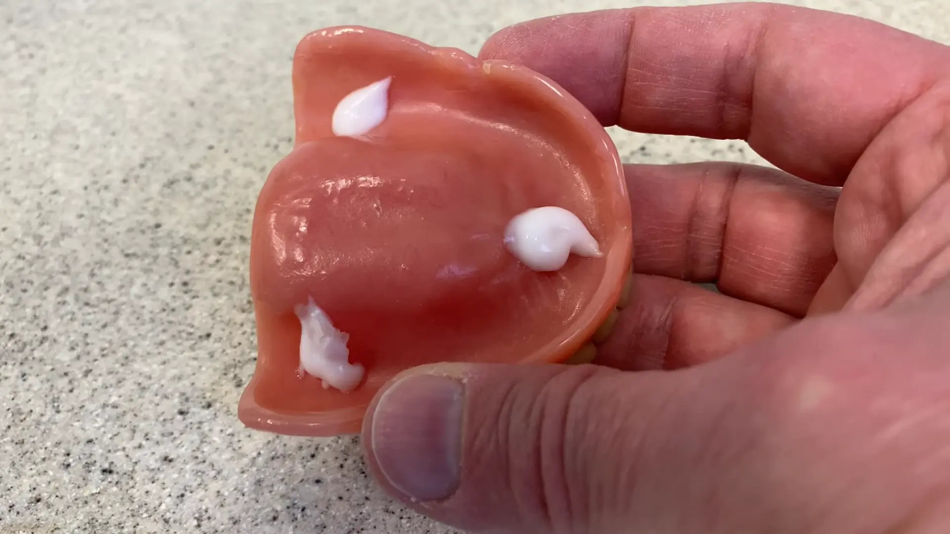 Introduction To Denture Glue