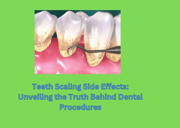 Teeth Scaling Side Effects