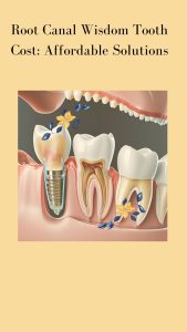 Root Canal Wisdom Tooth Cost: Affordable Solutions and Tips