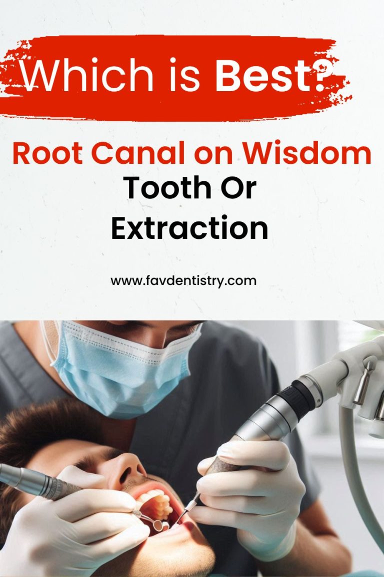 Root Canal on Wisdom Tooth