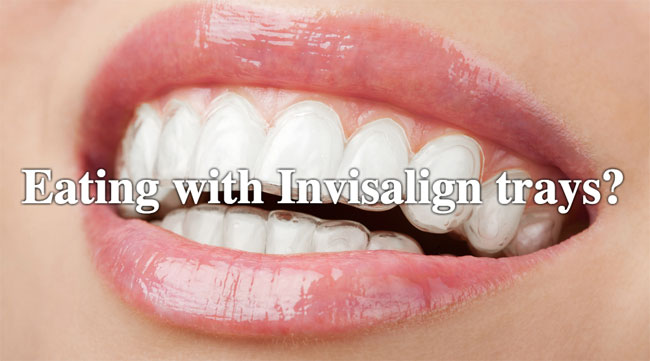 Can You Chew Ice With Invisalign