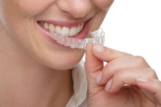 Cleaning Invisalign With Polident