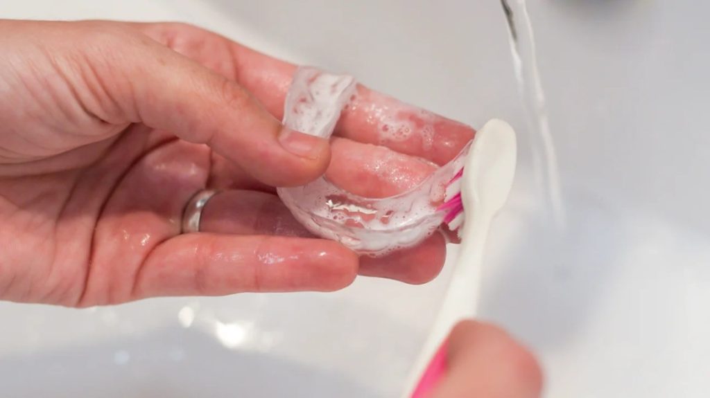How To Clean Invis Invisalign Case Smells? Banish Odors With These Tips!