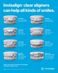 Invisalign for Malocclusion