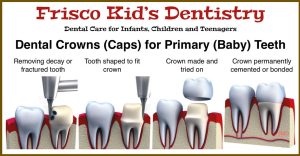 Tooth Crown for Kids