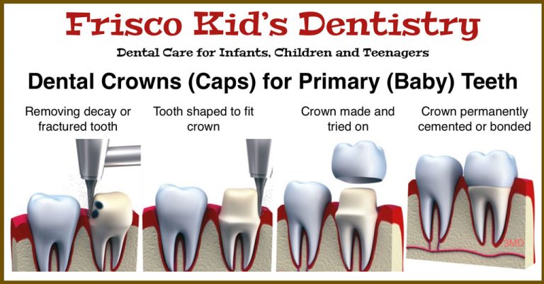 Tooth Crown for Kids